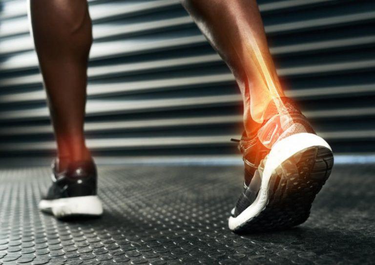 5 Frequently Asked Questions About Achilles Tendon Rupture