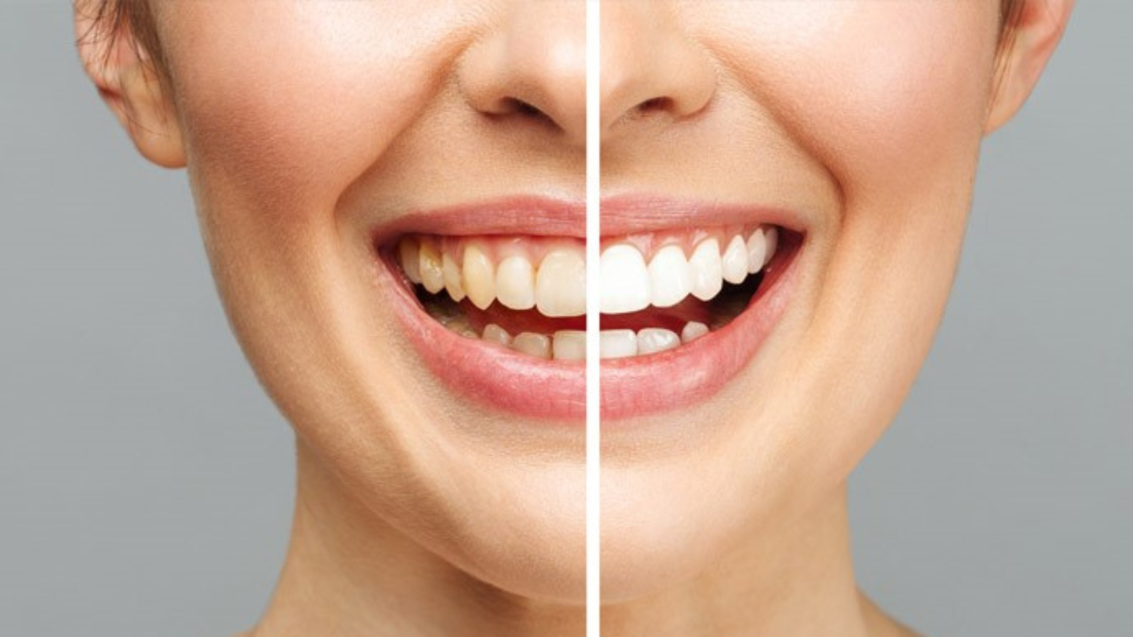 Coffee, Tea, or Wine? The Everyday Habits That Keep Staining Your Teeth—and How to Fight Back Coffee, Tea, or Wine? The Everyday Habits That Keep Staining Your Teeth—and How to Fight Back