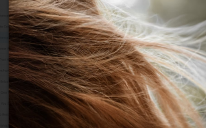 How to Choose a Hair Transplant Clinic